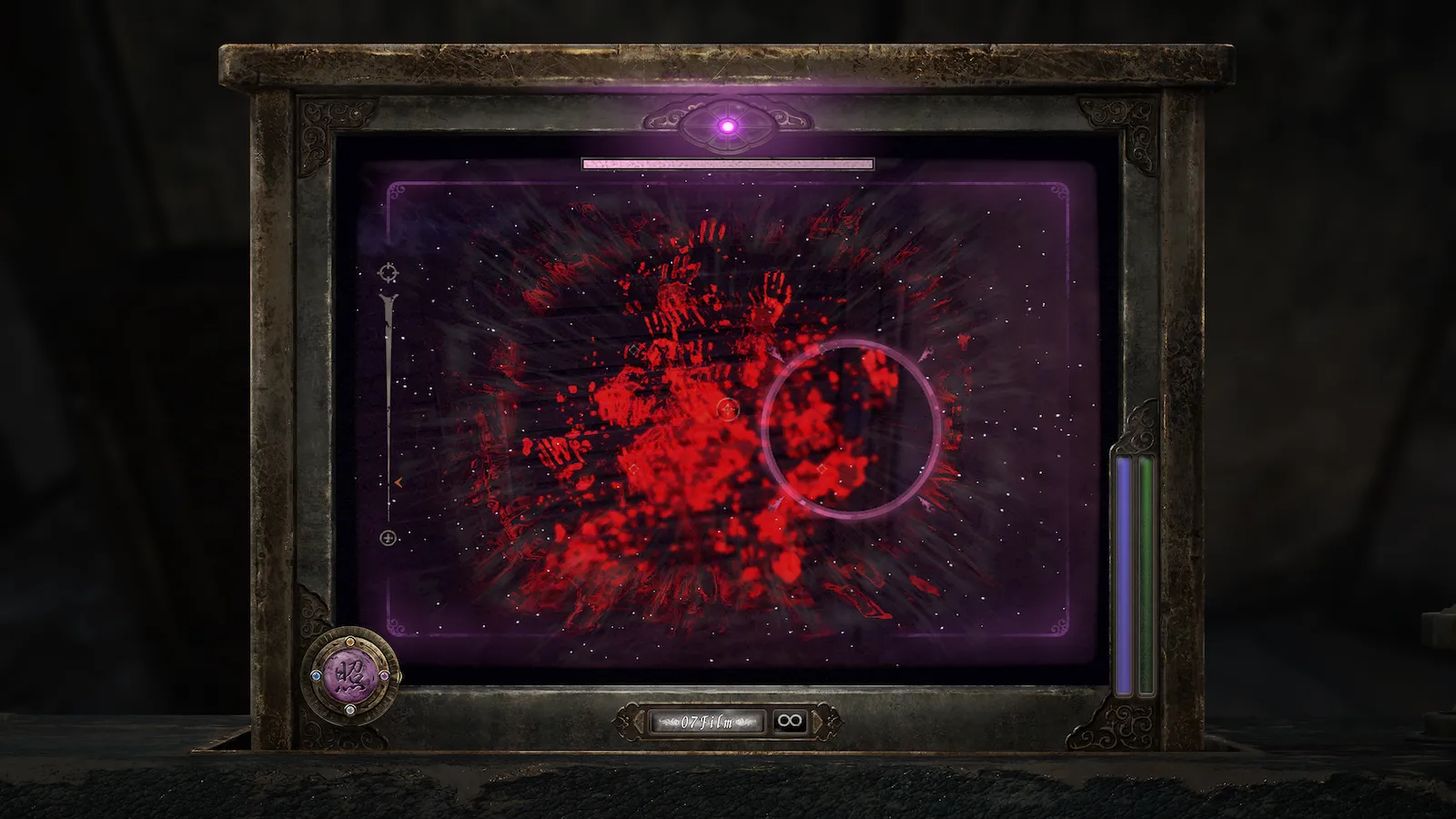 Frustration Behind The Camera